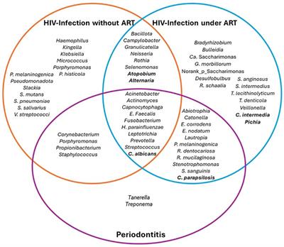 Human immunodeficiency virus and oral microbiota: mutual influence on the establishment of a viral gingival reservoir in individuals under antiretroviral therapy